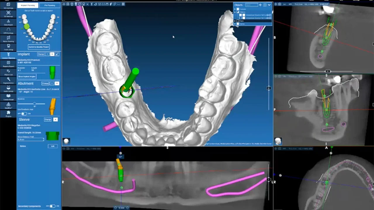 Basic-WEBINAR-ICX-MAGELLAN 03.09.2025